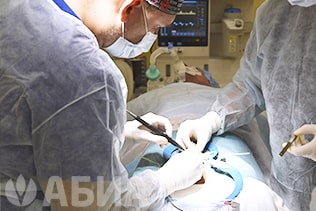 Операция фаллопротезирования