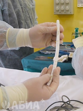 Фаллопротезирование полового члена