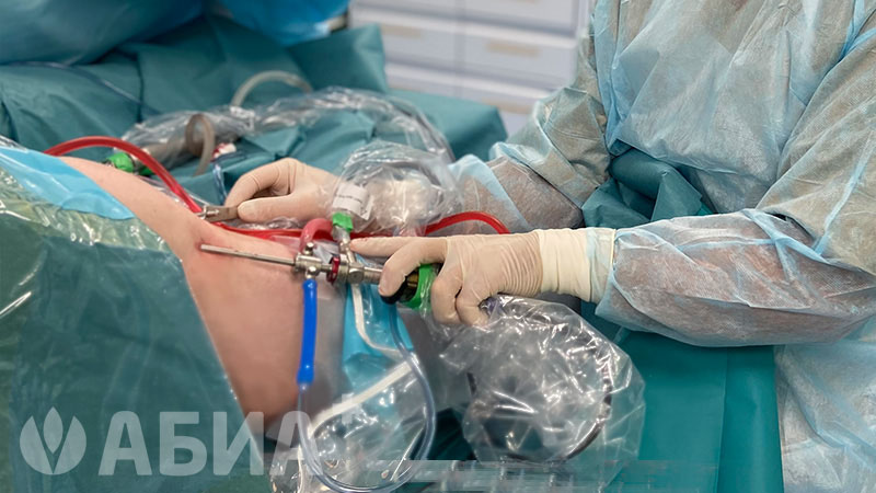 Артроскопическая операция