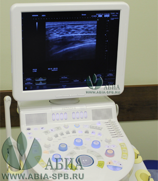 УЗИ молочных желез